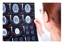 Brain Injury & Coma